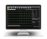 Edan SE1515 PC Based ECG