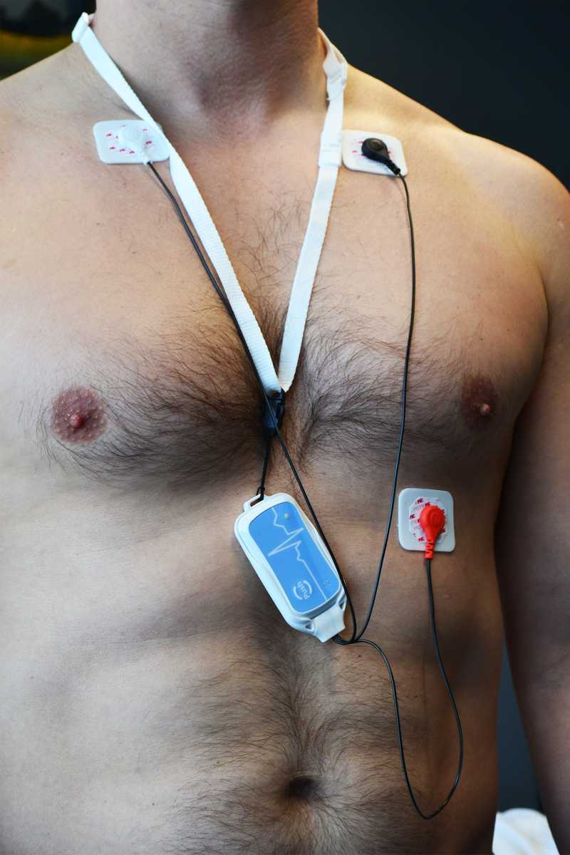 Trident Nano Holter Recorder